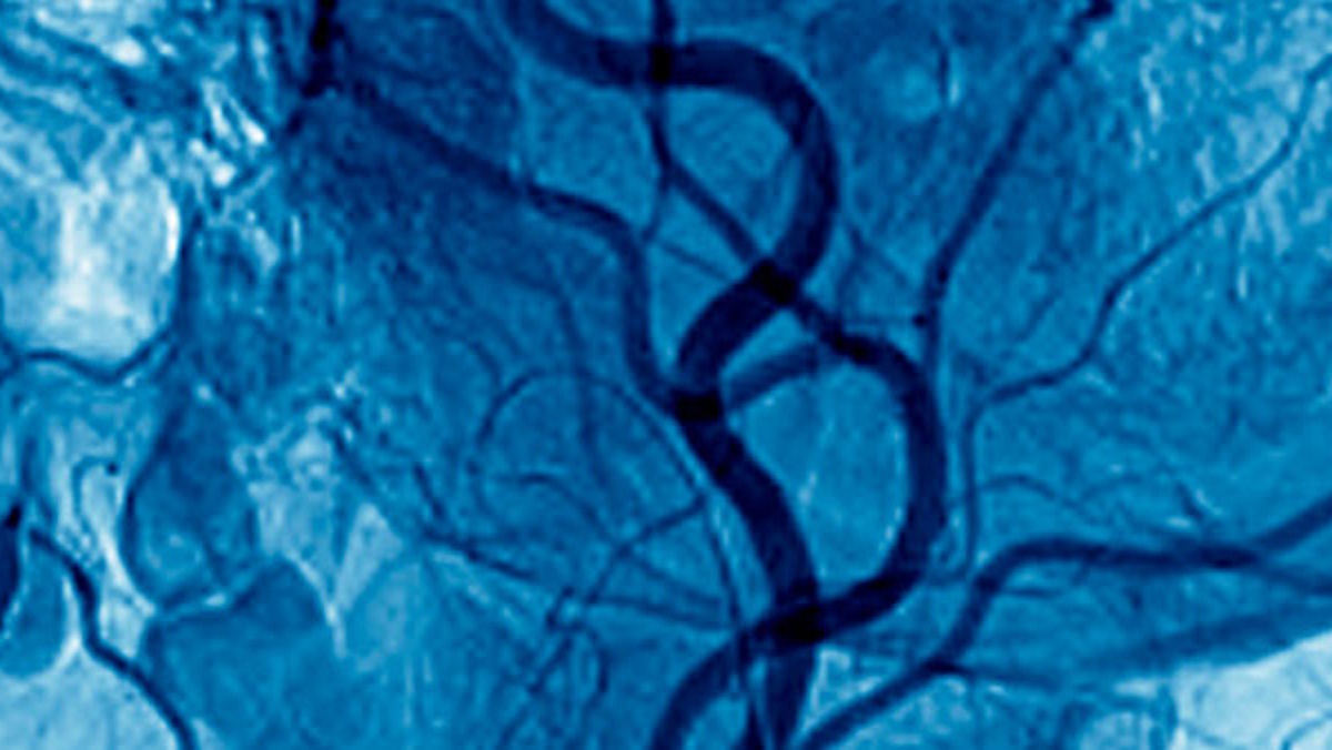 Thermal Imaging for the Diagnosis of Early Vascular Dysfunctions: A Case Report