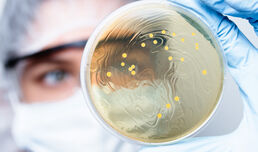 Characterization and determination of antibiotic susceptibility pattern of bacteria associated with untreated infected wound