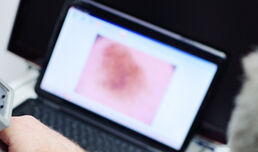 EADV - Dermatology during social distancing