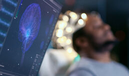 Cerebral venous thrombosis is on the rise, study finds
