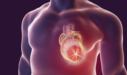 Catheter ablation linked to reduced risk of dementia in patients with atrial fibrillation