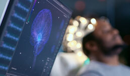 What EEGs tell us about COVID-19 and the brain
