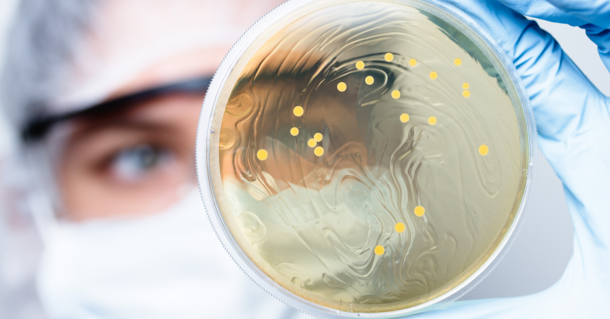 Lack of friendly vaginal bacteria associated with ovarian cancer
