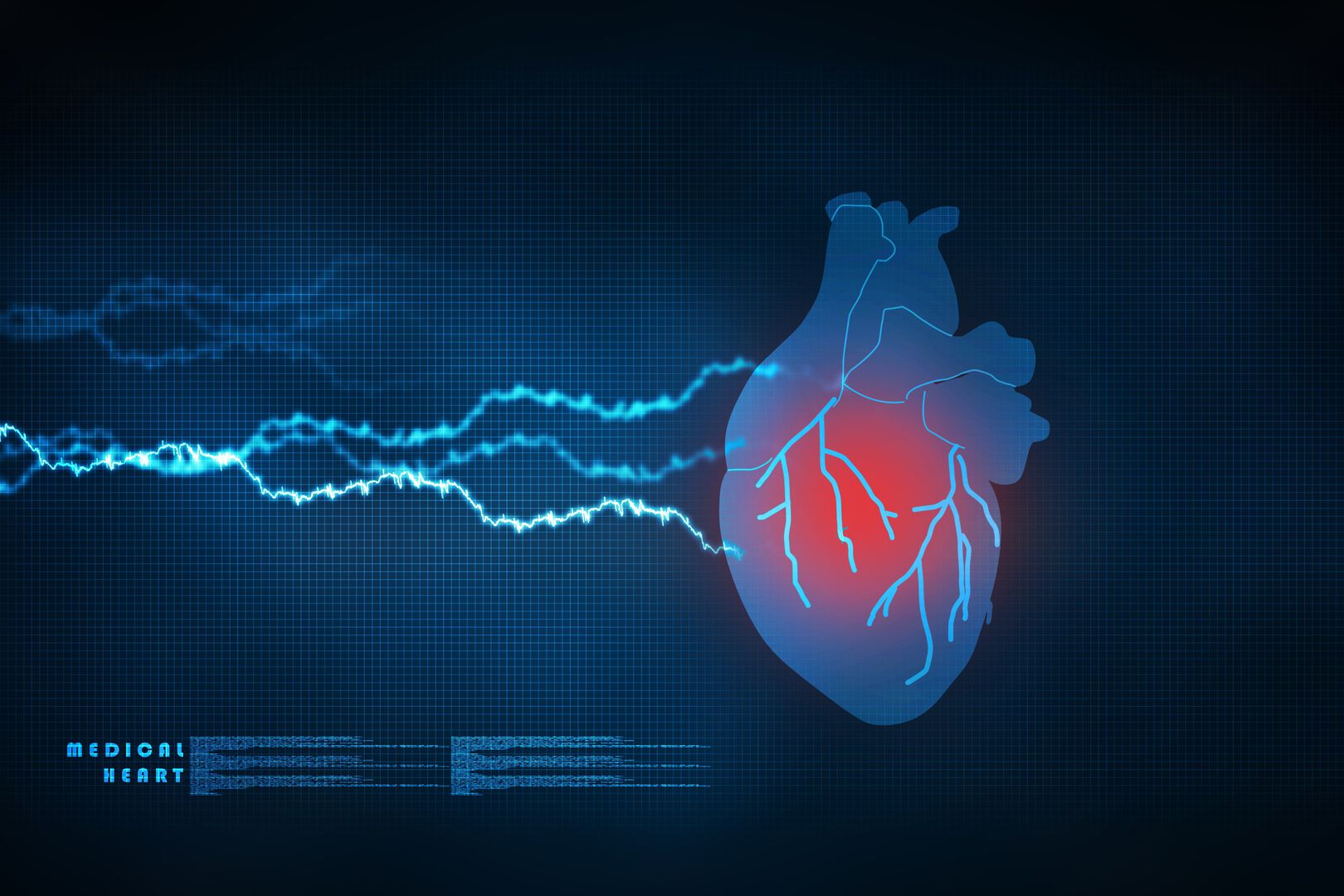 Pill 1-in-4 prevents heart problems