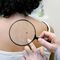 Management of Sentinel-Node Metastasis in Melanoma - Poll