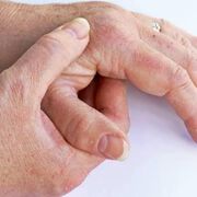 Tofacitinib or Adalimumab versus Placebo for Psoriatic Arthritis
