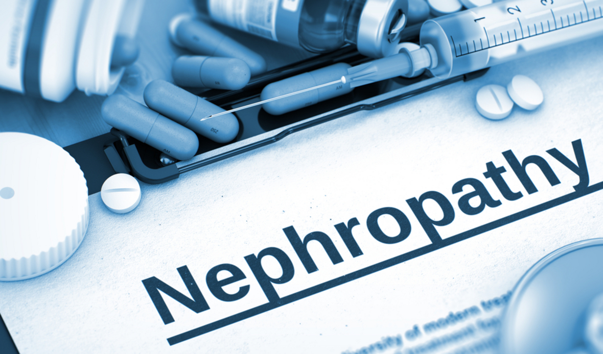 Incidence of stroke among diabetic nephropathypatients: A meta-analysis
