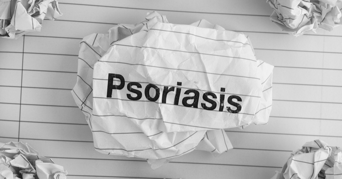 PEDIATRIC PSORIASIS treatment guidelines