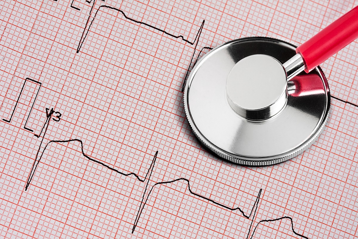 Anesthesia for Thoracic Aortic Aneurysm without Cardiopulmonary Bypass in Children