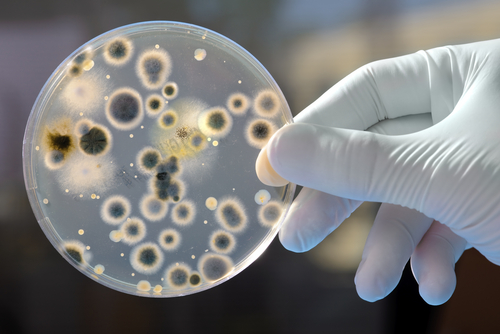 Fangnetze des Immunsystems benötigen Energie