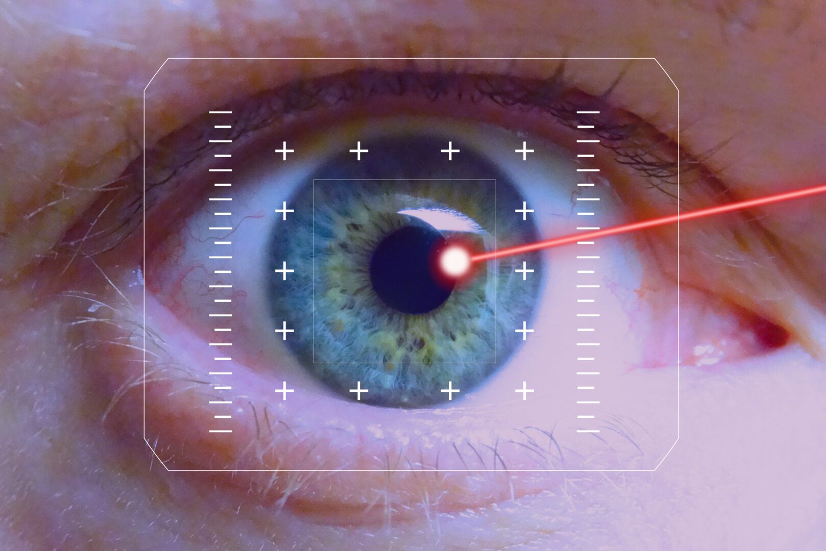 Im Trend: Augenlasern statt Brille tragen - Video