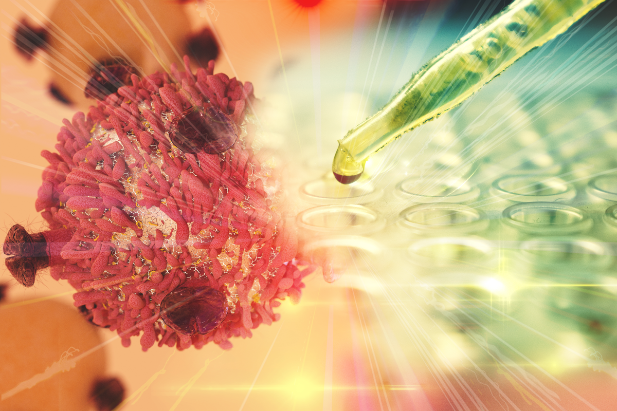 'BiTE'-Technologie zur Behandlung von akuter lymphatischer Leukämie