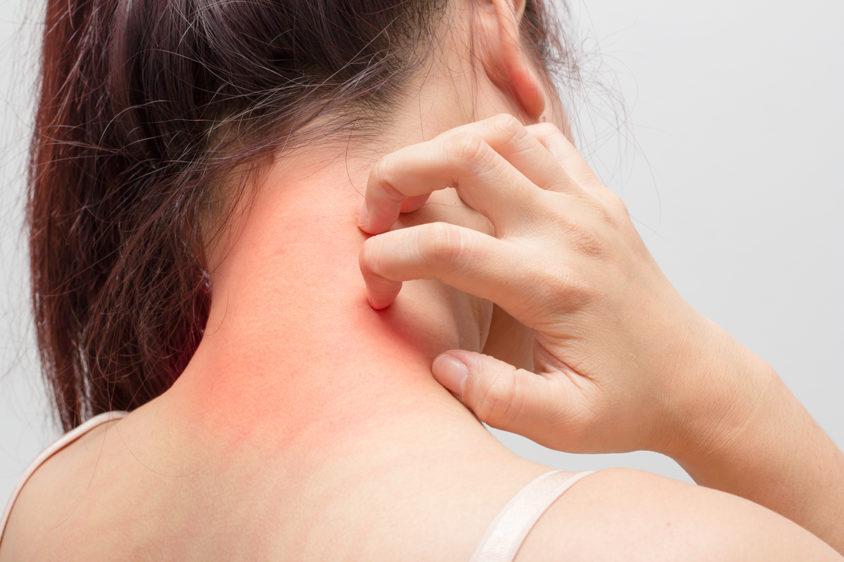 Allergien bringen kardiovaskuläre Risiken, aber auch gesundheitliche Vorteile