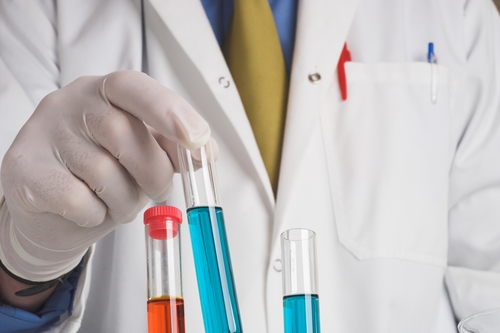 Möglicher Biomarker zur Früherkennung von Alzheimer und Parkinson gefunden