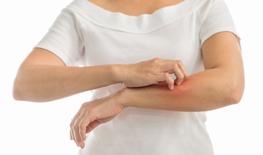 Botenstoff des Immunsystems neutralisiert Schuppenflechte-Symptome