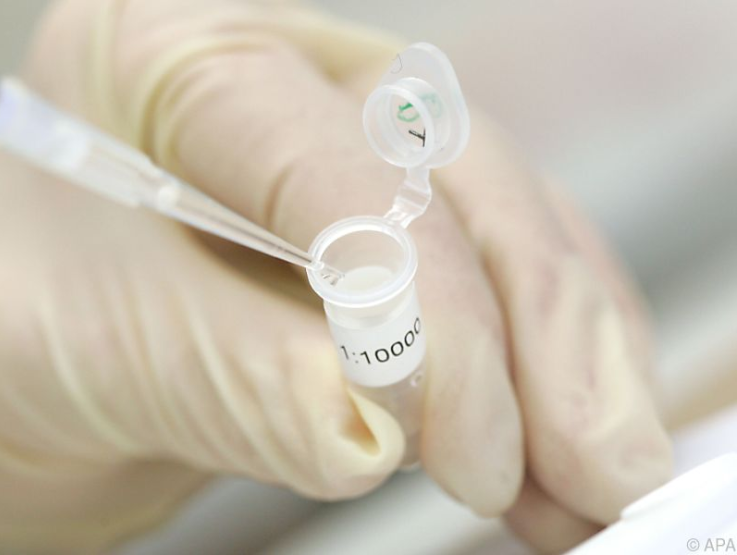 Das "böse" LDL-Cholesterin kann Entzündungen hemmen