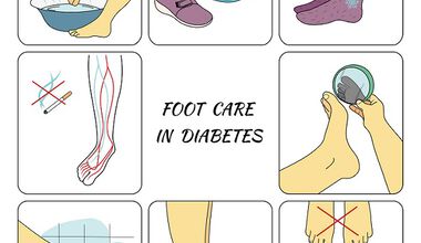 Грижа за стъпалата и избор на обувки при диабет (ВИДЕО)