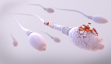 Spermienqualität und TCM - Video