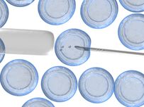 Try egg freezing before you are 35