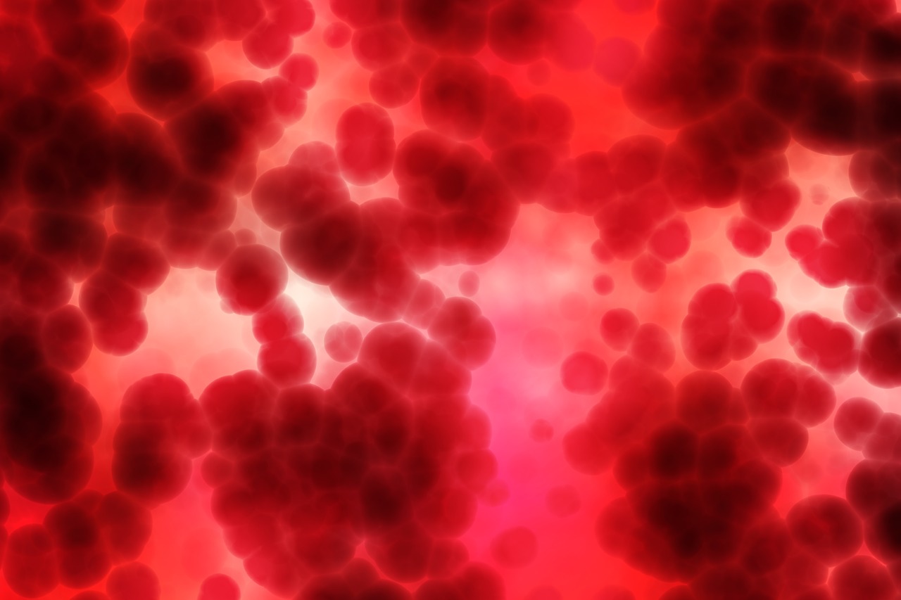 Patienten-Blut-Management: Eine Alternative zu Fremdbluttransfusionen
