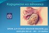 Карцином на яйчника