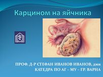 Карцином на яйчника