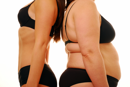 Leaky bladder can be result of excess pounds