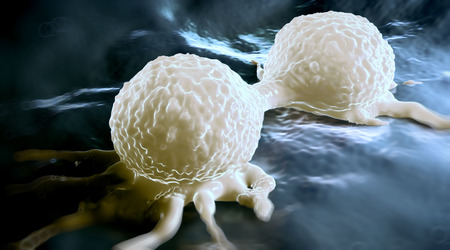 Brustkrebs: Biopsiegerät in Linz ermöglicht schnellere Diagnose