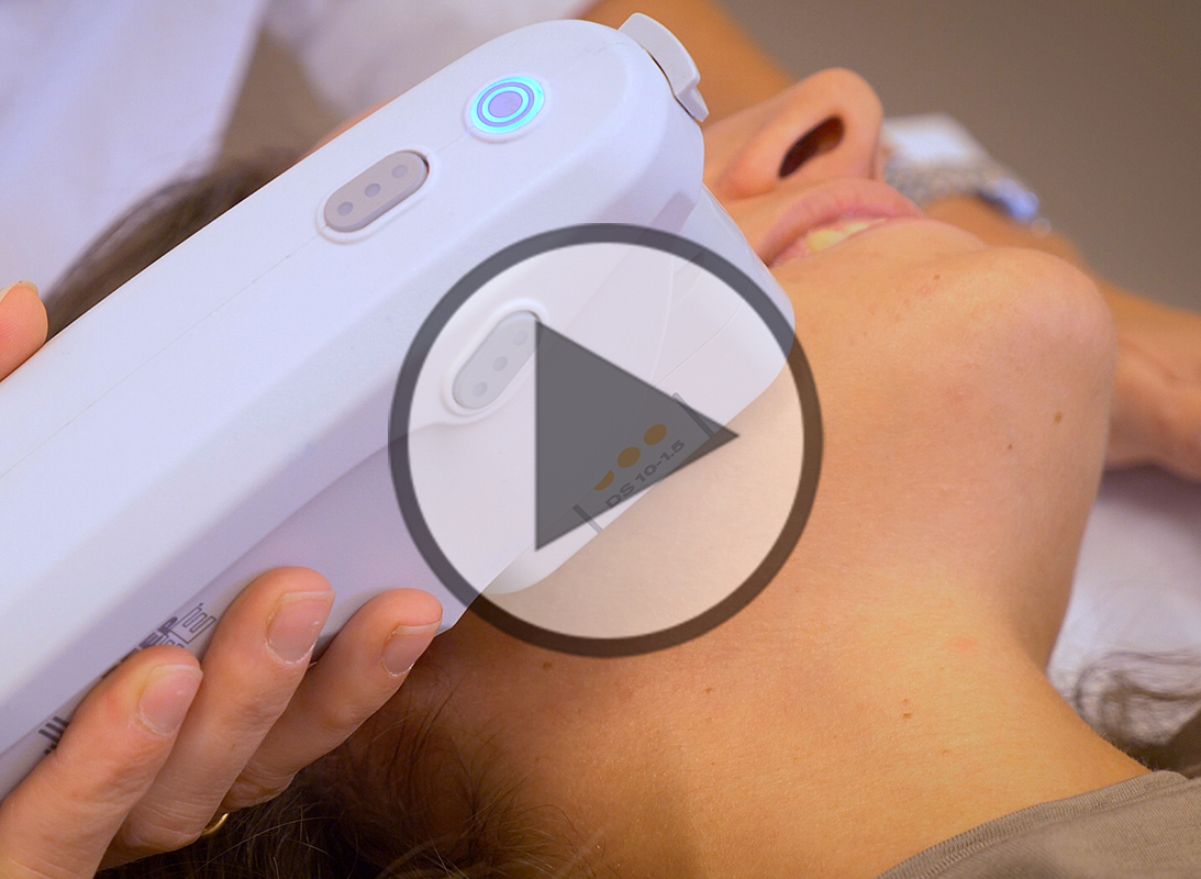 Was ist Ultherapy und für wen kommt sie in Frage? - Video