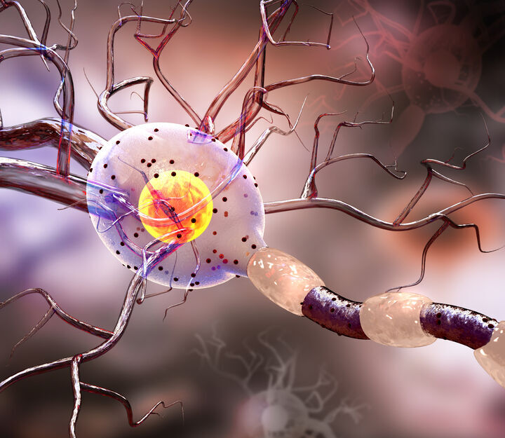 Wiener Studie: Kurz wirksames Opioid kann bei neuropathischen Schmerzen nach Gürtelrose helfen
