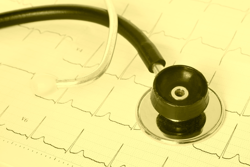 Defibrillation beim plötzlichen Herztod: Auf die Programmierung kommt es an