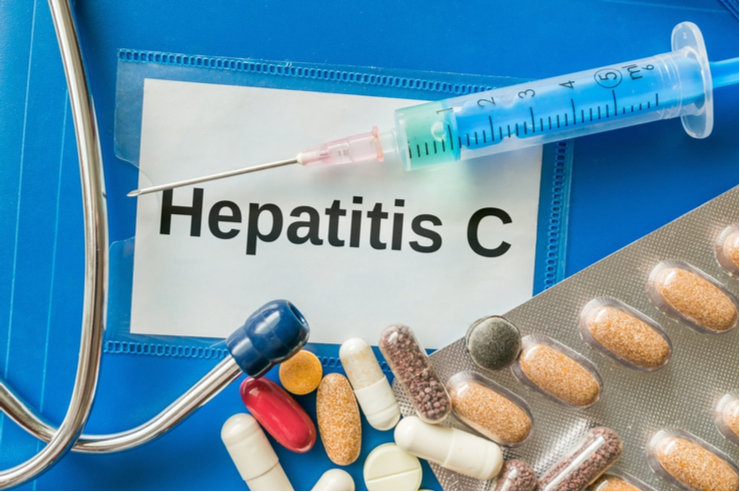 Interview mit Dr. Peter Ferenci: Behandlungsmöglichkeiten von Hepatitis C und Therapiealternativen