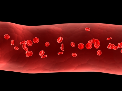 Neuer Entzündungs-Biomarker zeigt erhöhtes Thromboserisiko bei KrebspatientInnen an
