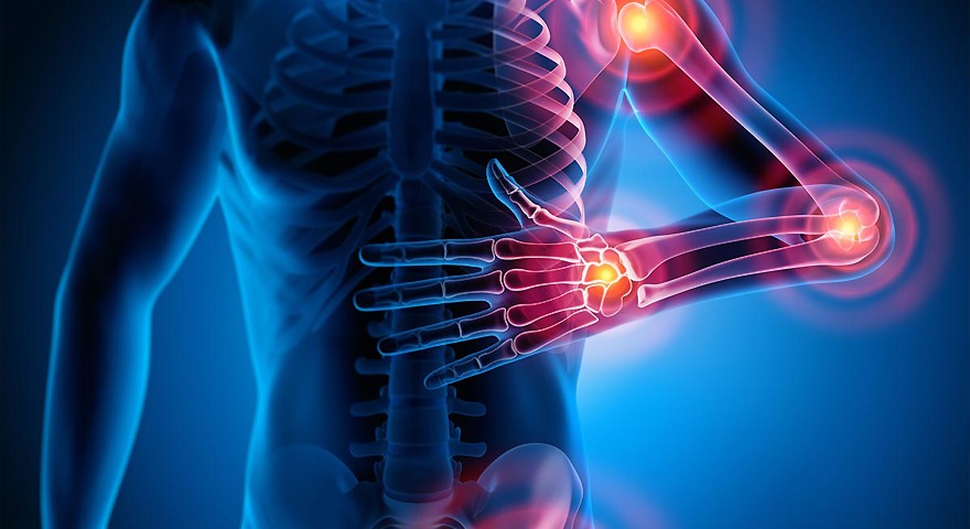 Diagnose Fibromyalgie- wie geht es jetzt weiter? - Video