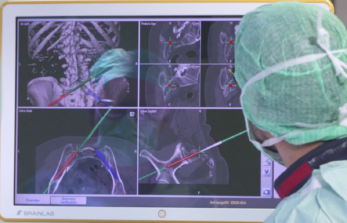 Ten Tips to Improve Iliosacral Screw Placement