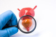 Neues Infoportal: meineprostata.at