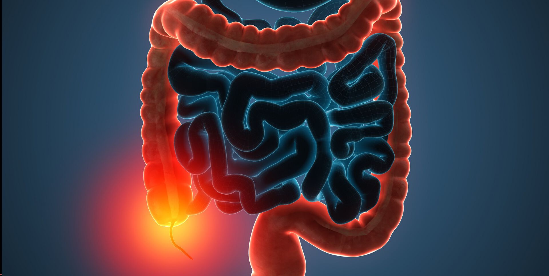 Малигнени заболявания и IBD