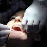 Die Anwendung der Physikalischen Gefäßtherapie im zahnchirurgischen Bereich