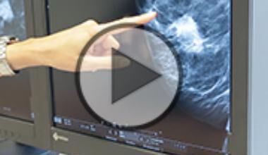 Sind Knoten in der Brust gefährlich? (Video)