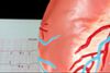 Herzinfarkt: Studie der Medizinischen Universität Innsbruck identifiziert neuen Risikofaktor