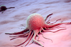 Immuntherapie: wie sich Krebszellen gegen die Immunzellen wehren
