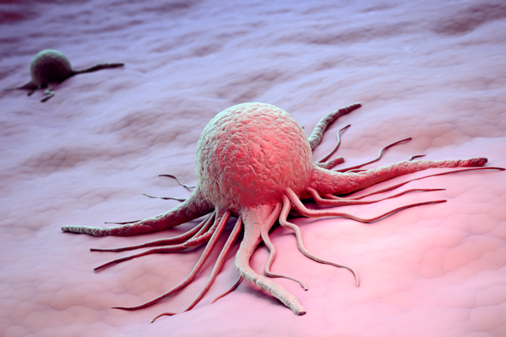 Immuntherapie: wie sich Krebszellen gegen die Immunzellen wehren
