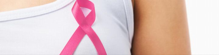 Med Uni Graz: Biomarker für Brustkrebs mit schlechten Heilungschancen gefunden