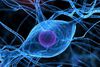 Multiple Sklerose: Cholesterin-Kristalle hemmen Regeneration im Zentralnervensystem