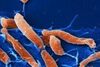 Helicobacter pylori-Infektionen verändern das Magenmilieu nachhaltig