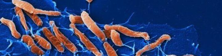 Helicobacter pylori-Infektionen verändern das Magenmilieu nachhaltig