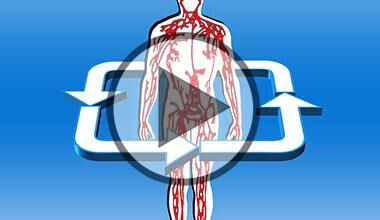 Atherosklerose & Durchblutungsstörungen - Video