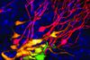 Teilung von Stammzellen im Gehirn erstmals beobachtet