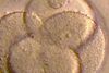 Forscher züchten erstmals menschliche Eizellen im Labor
