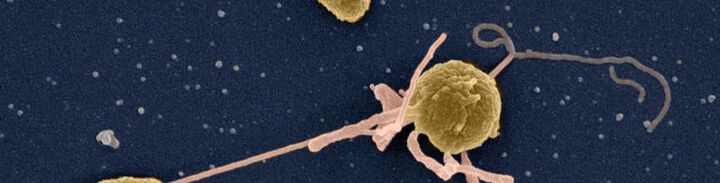 Cholera: Wie Bakterien im Darm überleben